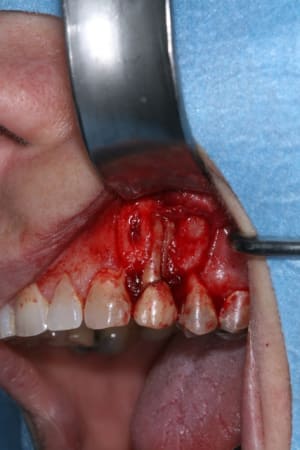 Lambeau lev  qrpmt7 - Eugenol