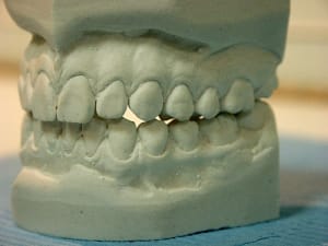 Latdroite2 cy1oz4 - Eugenol