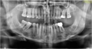 Ldz5n6zrjws4gpnatbz39aj8dyso - Eugenol