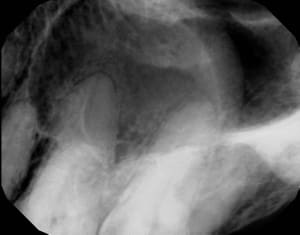 Lk4tjjfdrqhehldggohd - Eugenol