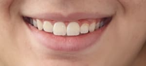 Lp5xkxgpffg1ajn2prs36srjy1xj - Eugenol
