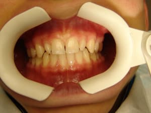 Lq2 lue0gm - Eugenol