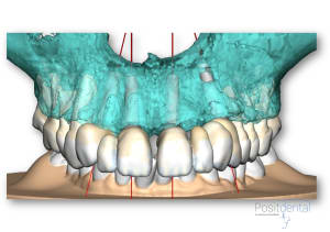 Lt8pswrup56agqta08fqdg5rssqh - Eugenol