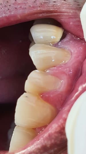 Lu1ptovgwyrwdt7sc4ac - Eugenol