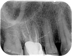 Lvndbcghzhj4fjvmsmzt - Eugenol