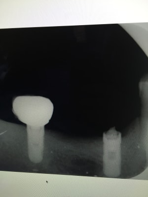 M6dwokdup30xnmrw7imo - Eugenol