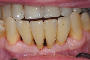 Mai2009 q6annw - Eugenol
