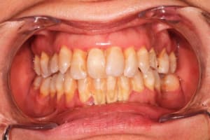 Mars2016 070 qg5blr - Eugenol