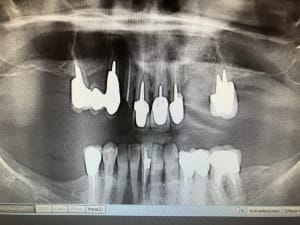 Mbickylqzb3olbql4rbo - Eugenol
