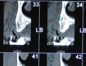 Mesure sur scan uiqwlk - Eugenol