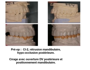 Montage nm  1  aslday - Eugenol