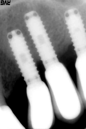 N7cs2mt3x54u1vgmpgpb6gqt2emd - Eugenol