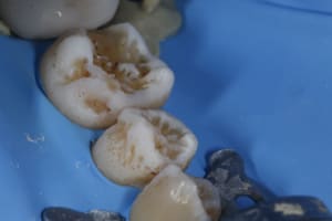 Nnnyv0uo58zyqxvp2bxqdmvyrjc4 - Eugenol