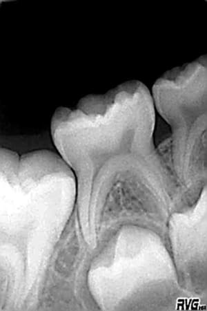 Novembre 05 i99poh - Eugenol