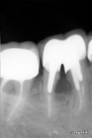 Osjuin2009 izpmme - Eugenol
