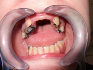 Ouvert tedtod - Eugenol