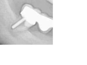 Pano bridge fract extrait sjdtk8 - Eugenol