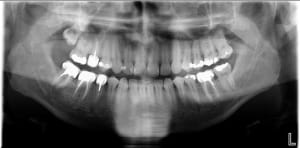 Pano bruno sxfbb3 - Eugenol