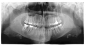 Pano k4dbyb - Eugenol