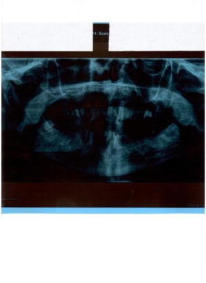 Pano tb3 001 bjxn2m - Eugenol
