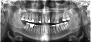 Pano w2vqyn - Eugenol