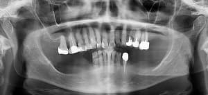 Pano y4eodq - Eugenol
