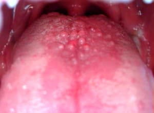 Papille izszxg - Eugenol