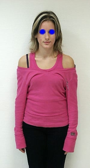 Patientedeface zyjdvf - Eugenol