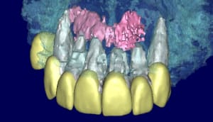 Patricia 3d2 kbvz9b - Eugenol