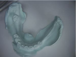 Peng 5 blpmdv - Eugenol