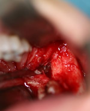 Per op1 akymkh - Eugenol