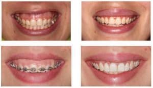 Pgzyohej81y4zruuxbtd - Eugenol