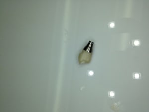 Photo 1 jlh1vb - Eugenol