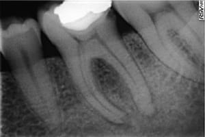 Photo 1 zwnl7m - Eugenol
