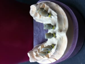 Photo  2  dqbljk - Eugenol