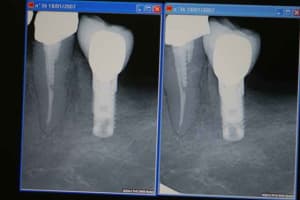 Photo ia8jt0 - Eugenol