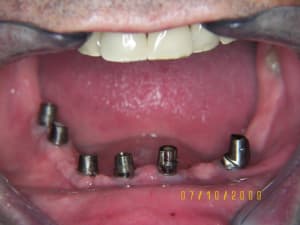 Pilier34 tres angul  pnd0m1 - Eugenol