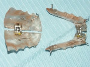 Plaques t4whhp - Eugenol