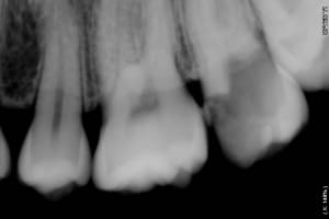 Pntdkcw1m0mrxsravqdq - Eugenol