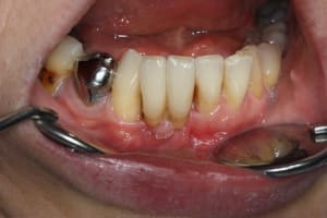 Pose dqxiyo - Eugenol