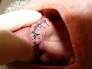 Post op nmxfja - Eugenol