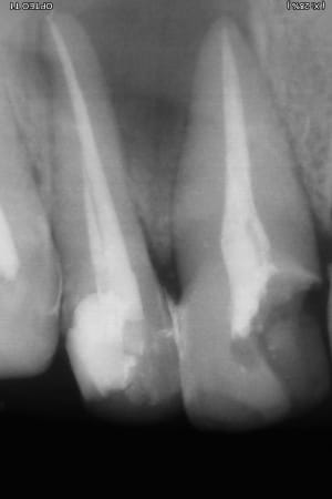 Post rte 21 22 g7ssro - Eugenol
