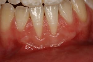 Pr  op 24 03 2011 et per op 001 bv3hga - Eugenol