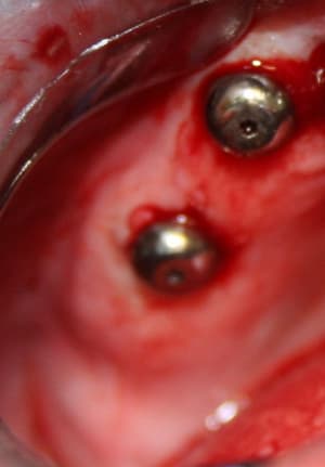 Pre op rxb7lo - Eugenol
