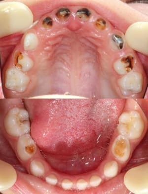 Preop hzhseu - Eugenol