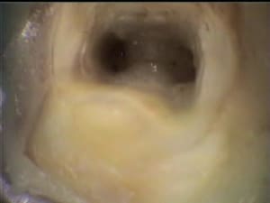 Pria2 - Eugenol