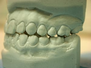 Propulsiong dxzwrp - Eugenol