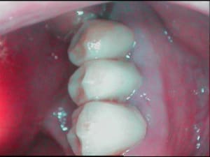 Prov ejfptk - Eugenol
