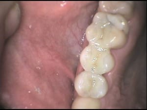 R2 y662fa - Eugenol