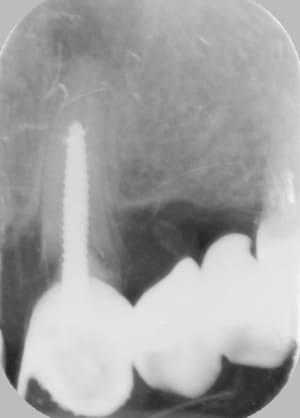 Radio uqew2q - Eugenol